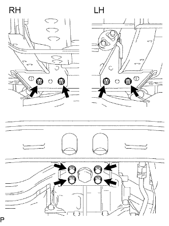 A01DX1WE04