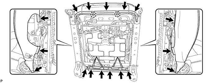 A01DYXT