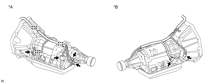 A01DYZUE01