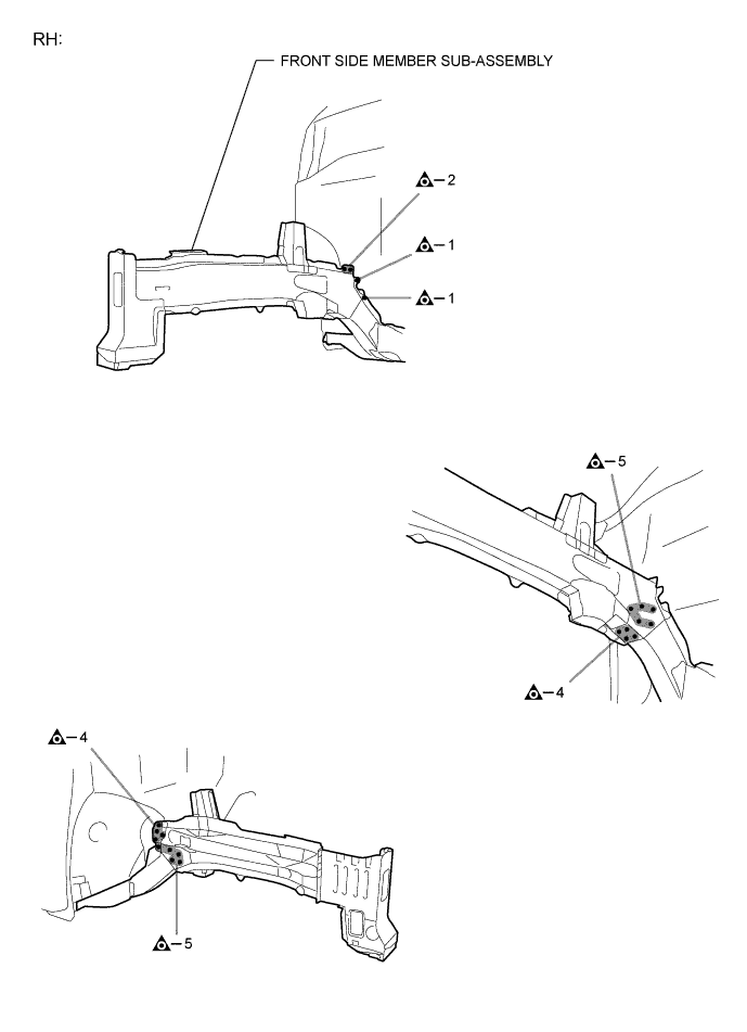 A00YIMBE01