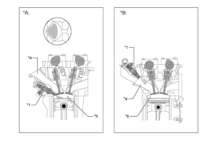 A01FBKZE01