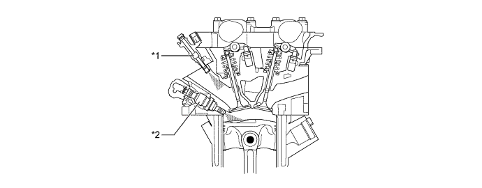 A01FPNUE01