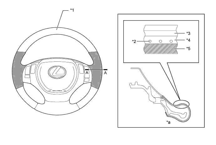 A01GVPME01