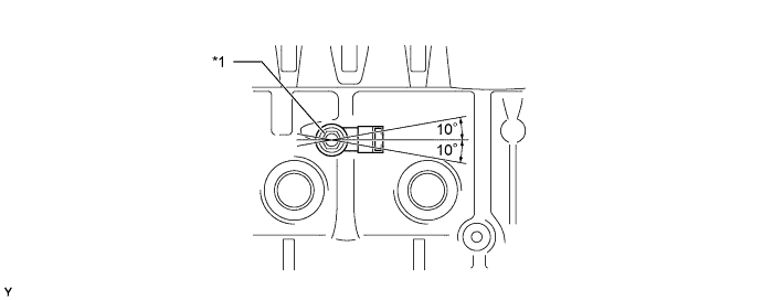 A01DLEZE01