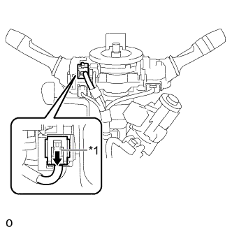 A01BATXE01