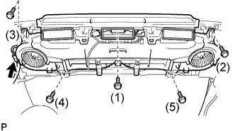 A01BB14E01