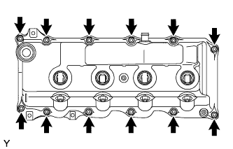 A01BBDL