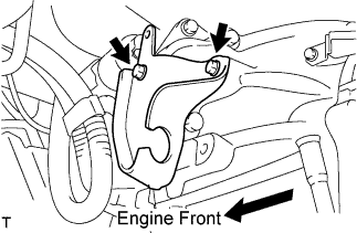 A01BBN4E02