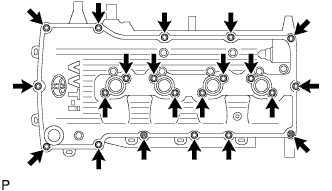 A01BCT5