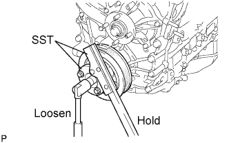 A01BCTUE01