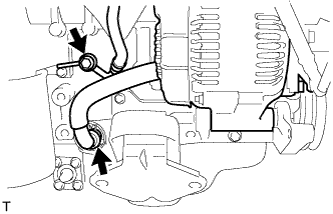 A01BFJB