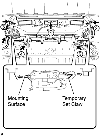 A01BFT5E01