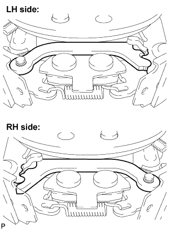 A01BFTIE01