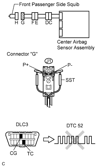 A01BFXYE01