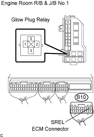 A01BI4BE02