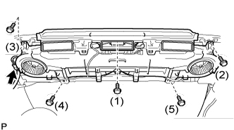 A01BB14E01