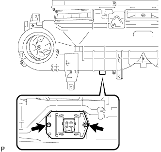 A01BB7U