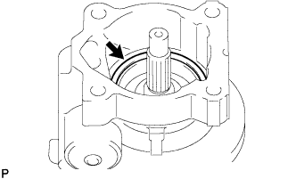 A01BBZL