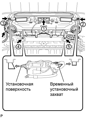 A01BFT5E01