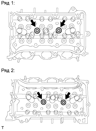 A01NERVE11