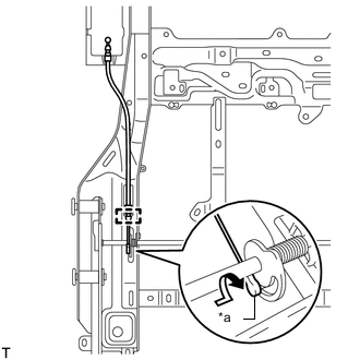 A01A87MC02