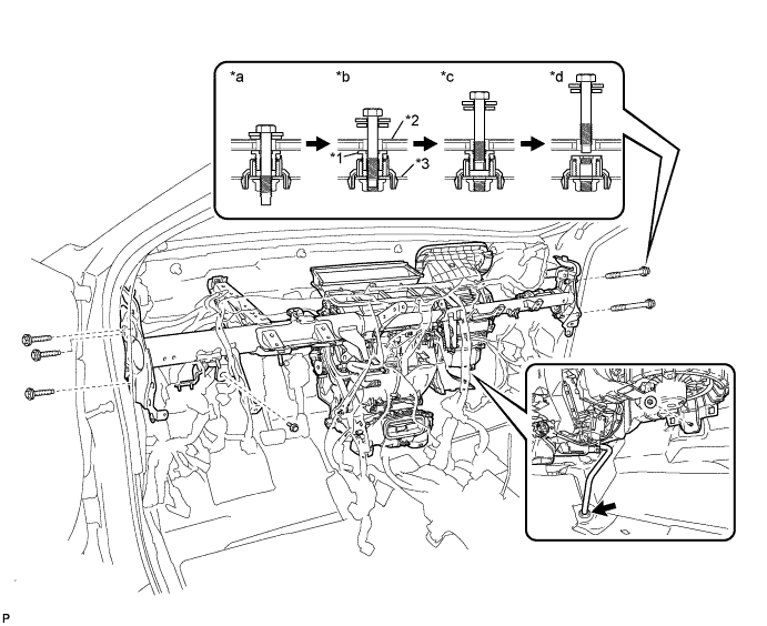 A01ESP4E01