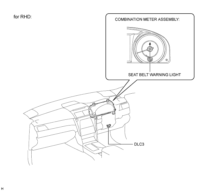 A01ESVBE01