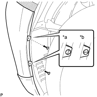 A01NKHIE01