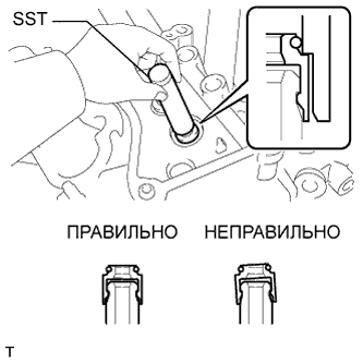 A01NLOBE02