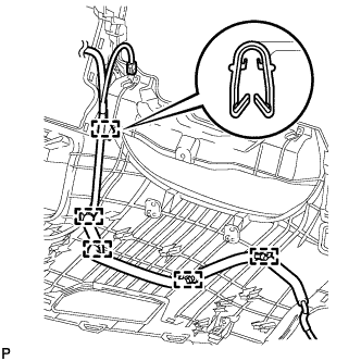 A01NLP1