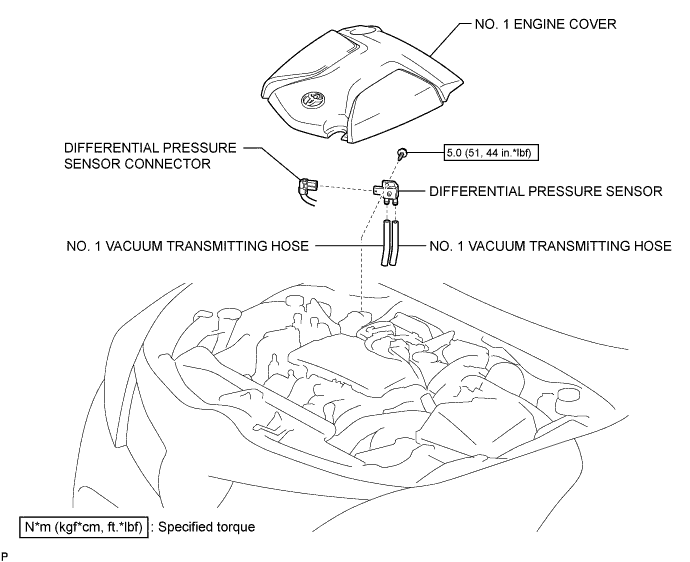 A01IMZOE01