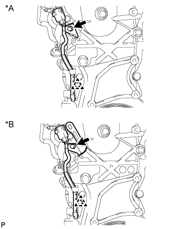 A01IPTRE01