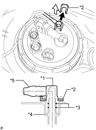 A01IQACE01