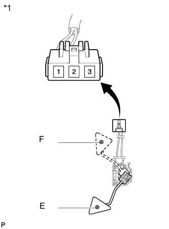 A01IRCNE01