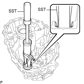 A01INJNE01