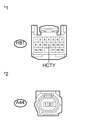 A01IRMPE04