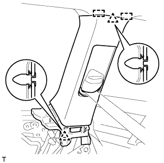 A00XJ7M