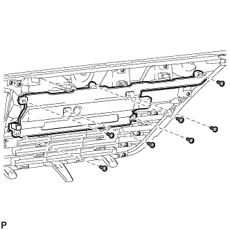 A01CBAC