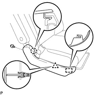 A01CBOQ