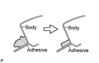 A01CBPNE02