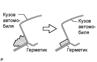 A01CBPNE03