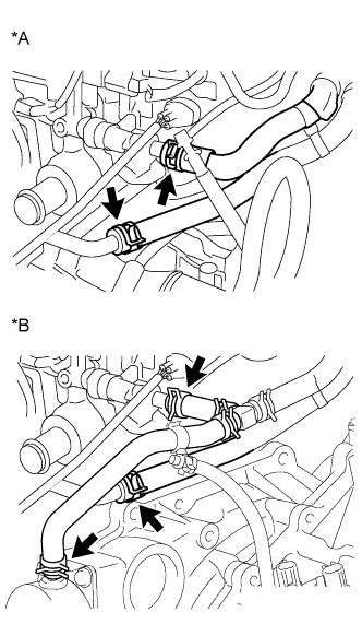 A01CG5PE02