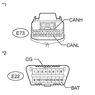 A01ENZBE87