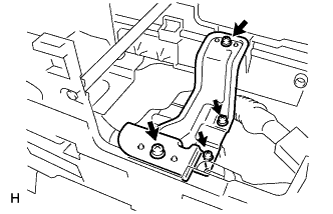 A01GHX5E01