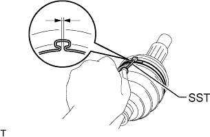 A01GMMBE06