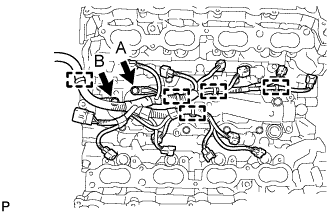 A01GNRAE01