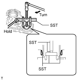 A01GZKFE01