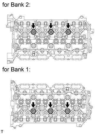 A01GZTKE02