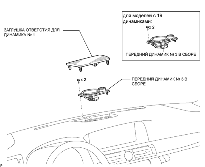 A01GZMWE01