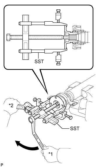 A01ELMYE03